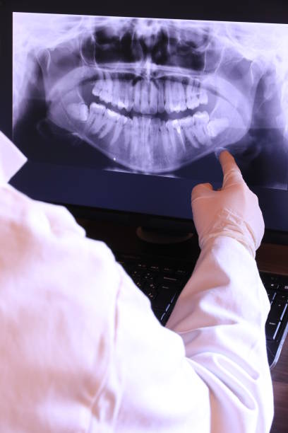 Best Emergency Root Canal Treatment in Orion, IL