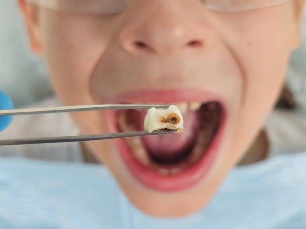 Best After-Hours Emergency Dentist in Orion, IL