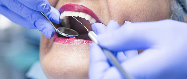Best Emergency Tooth Extraction in Orion, IL